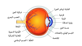 Cataract